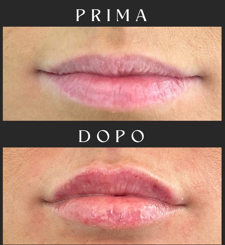 Prima e dopo il trattamento