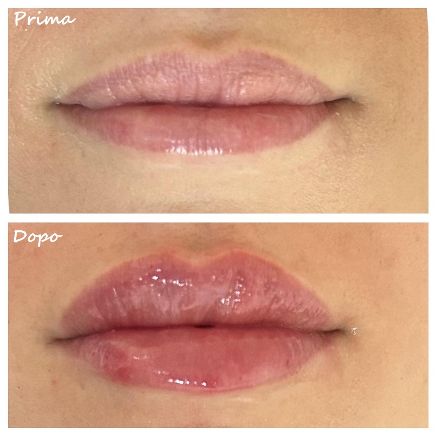 Prima e dopo il trattamento