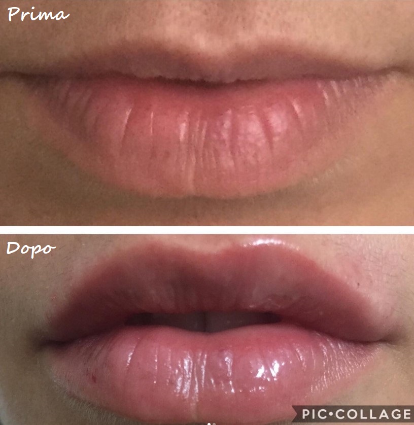 Prima e dopo il trattamento