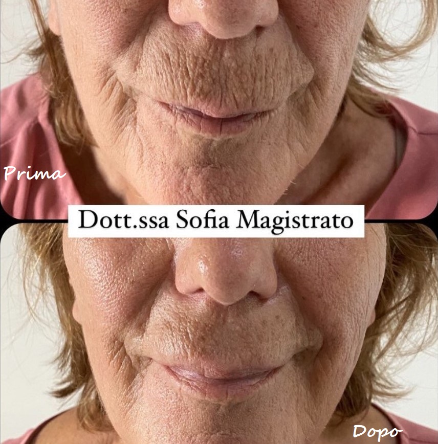 Prima e dopo il trattamento