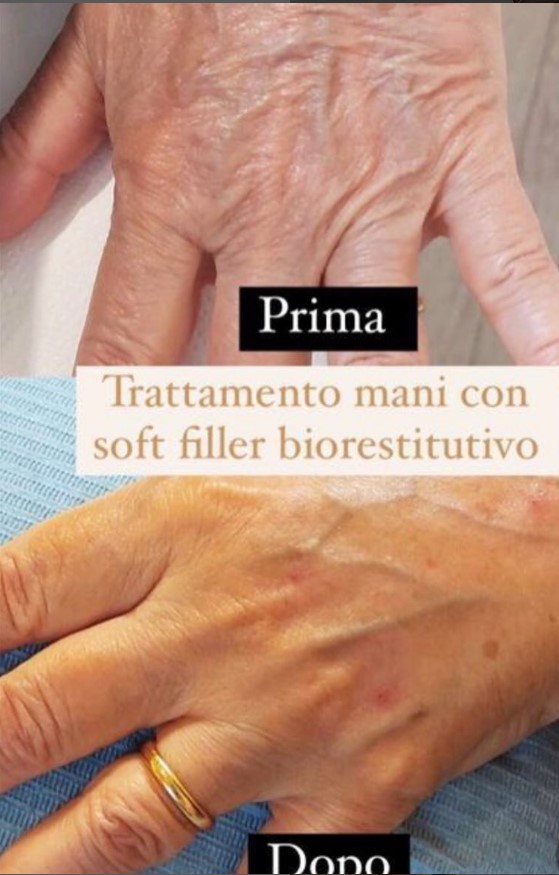 Prima e dopo il trattamento