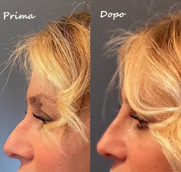 Prima e dopo il trattamento