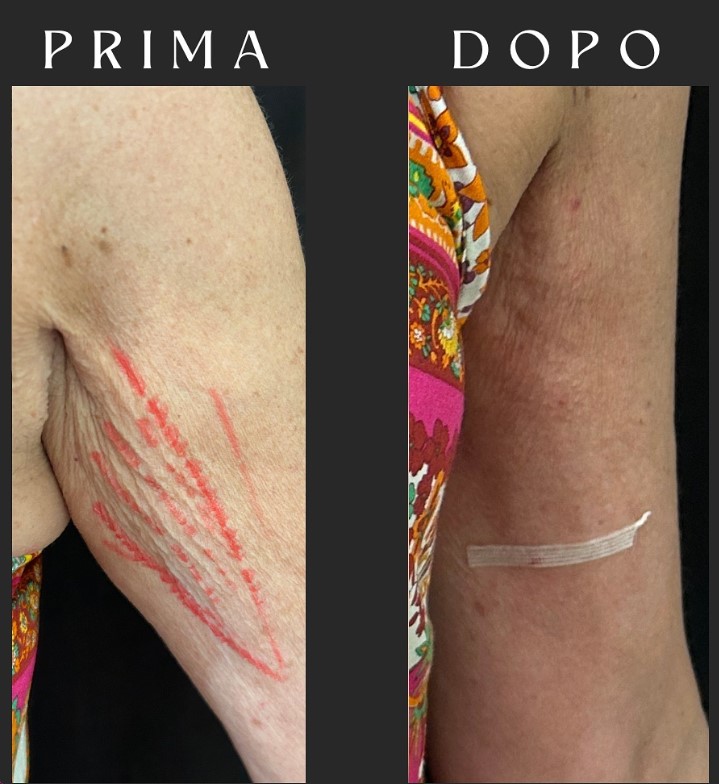 Prima e dopo il trattamento