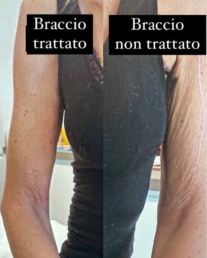 Prima e dopo il trattamento